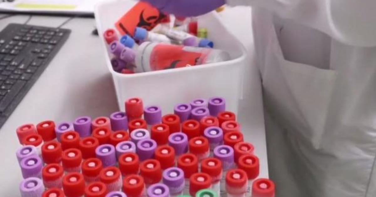 Pentagon agency "DARPA" searches to find the most potent
coronavirus antibodies 1