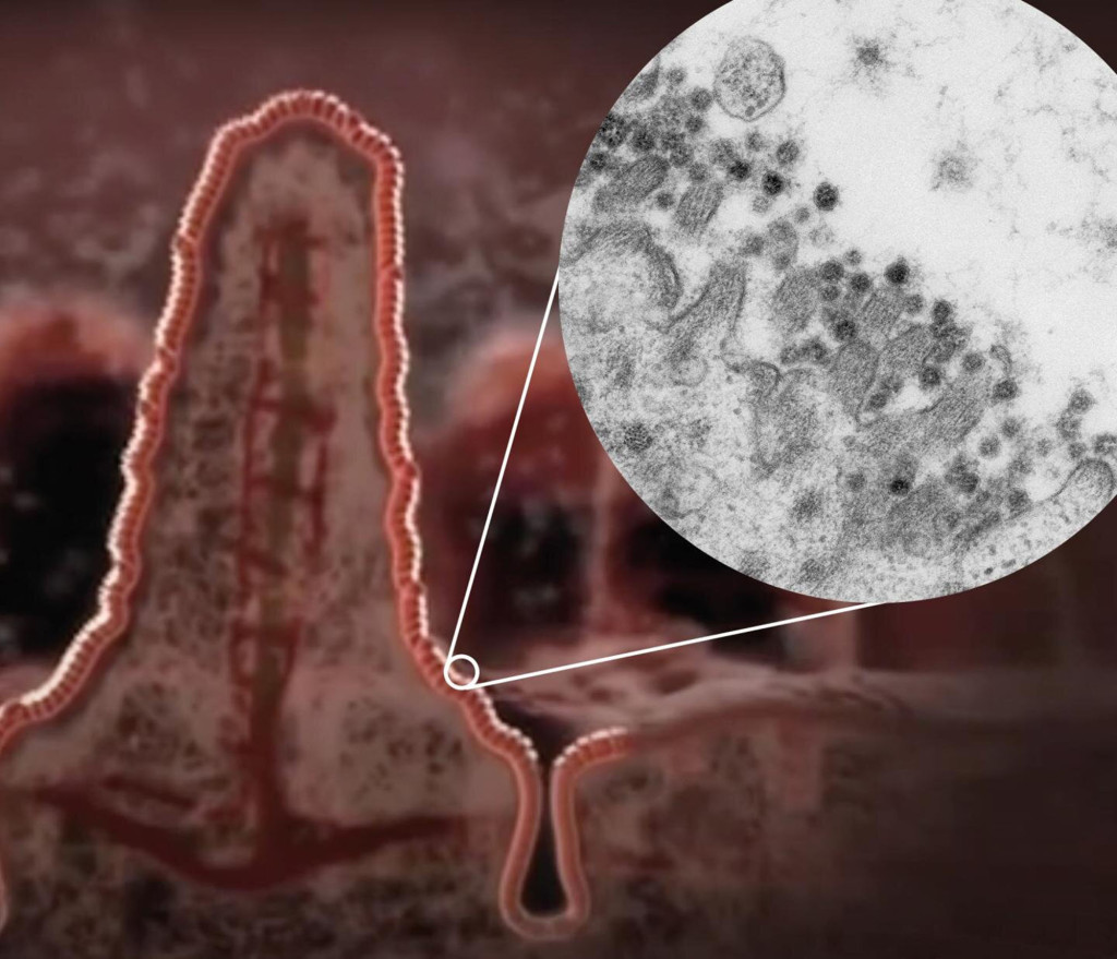 Coronavirus bug multiplies in the gut, detailed images
show 1