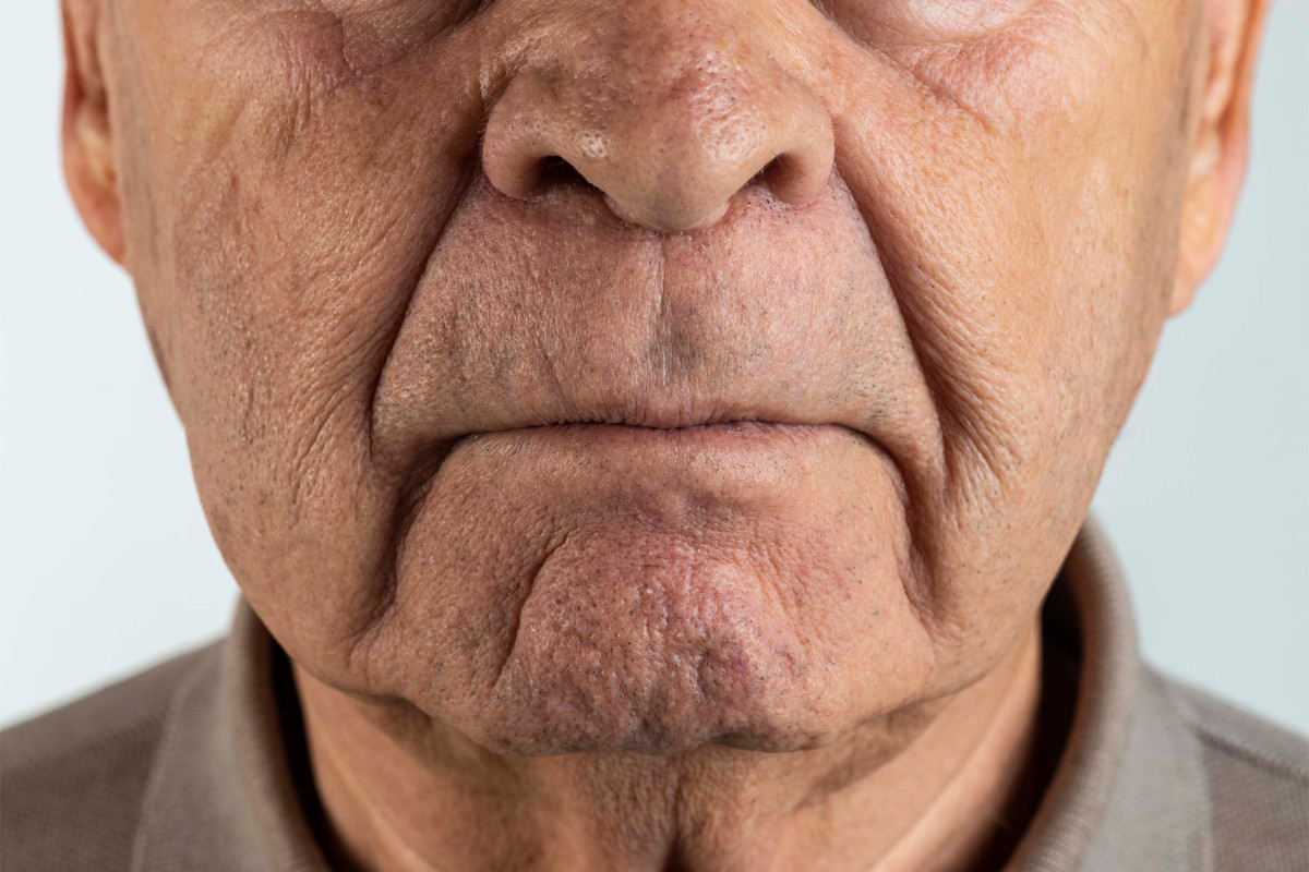 Older people’s noses may make them more vulnerable to
coronavirus: study 1