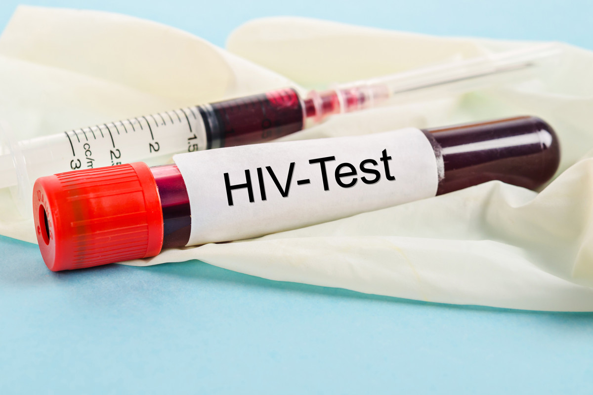 UK’s coronavirus lockdown could help ‘wipe out’ HIV, clinic
claims 1