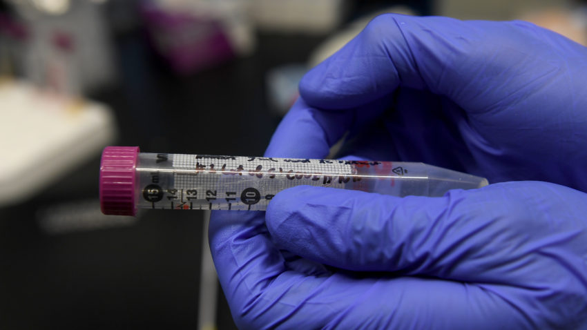 Two Pittsfield police officers recover from the coronavirus
and share what it's like to donate plasma 1