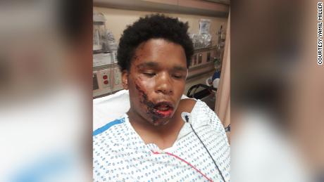 Protesters in New York detail alleged police abuse at
demonstrations 1