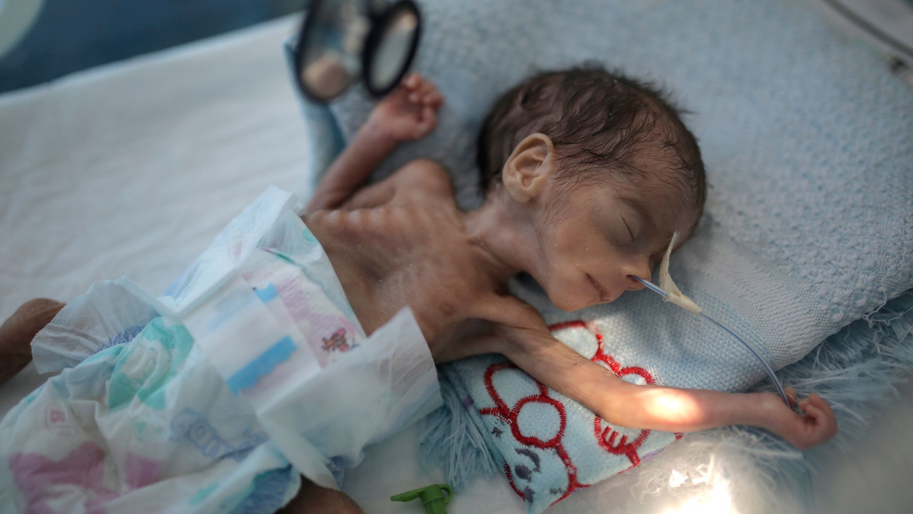 Millions Of Children Could Starve As Coronavirus Sweeps
Across Yemen, UNICEF Says 1