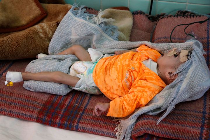 Yemen’s Coronavirus Catastrophe Is A Global
Embarrassment 1