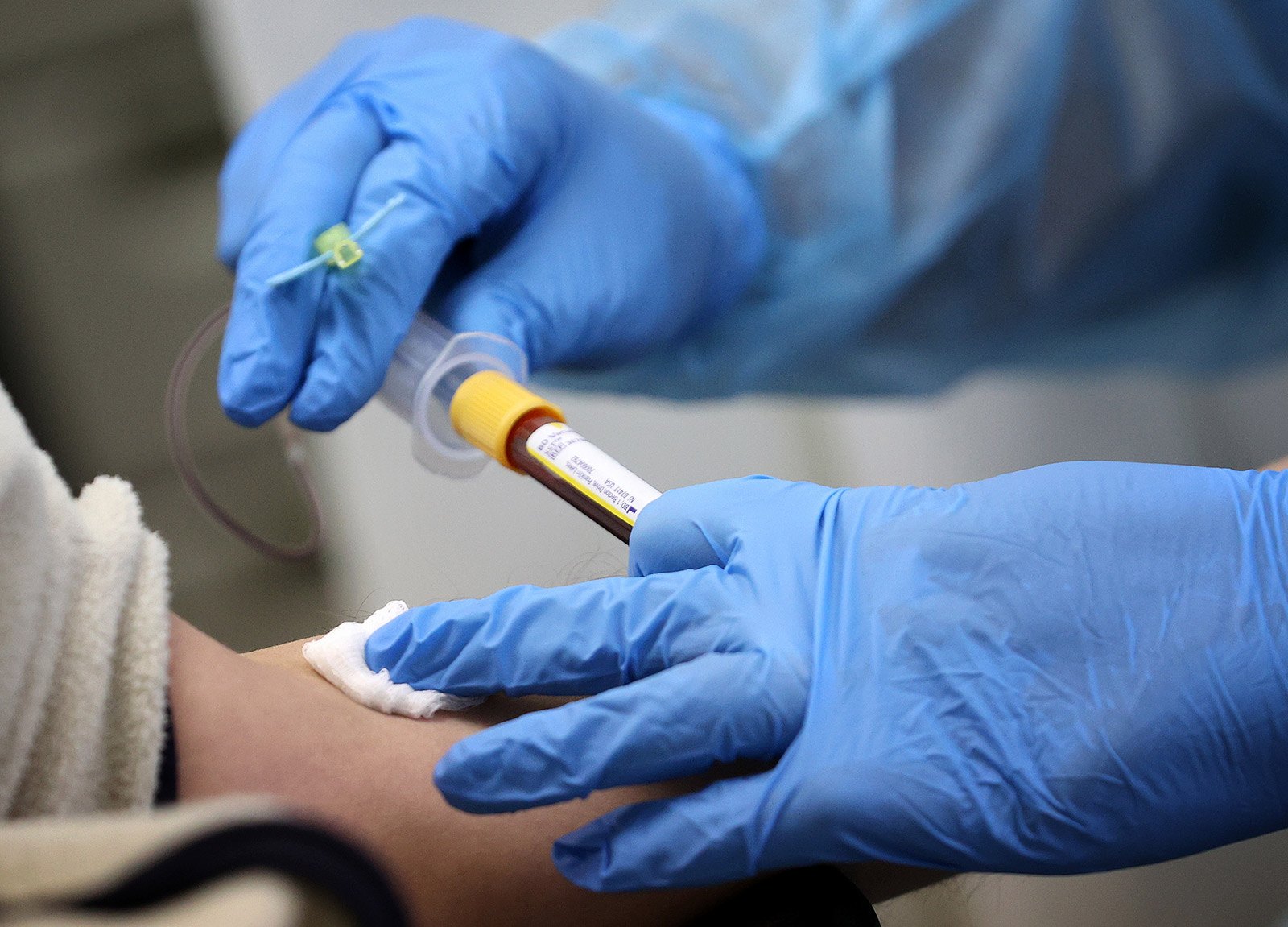 How new coronavirus cases in the US compare to other
countries 1