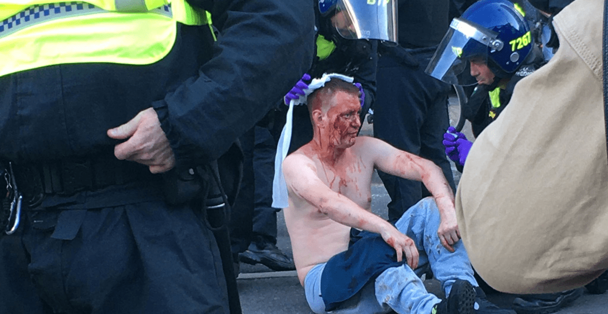 EXCLUSIVE VIDEO: London #BLM Protesters Become Violent,
Attack Man After Claiming He’s With EDL 1