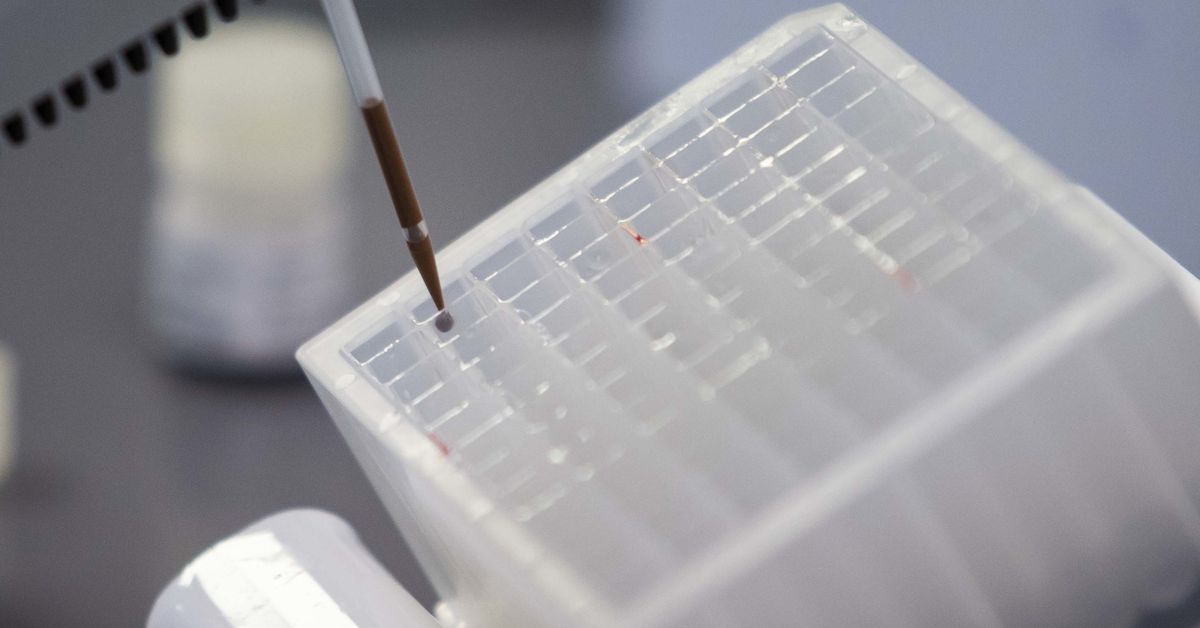 72 more Illinois coronavirus deaths 1