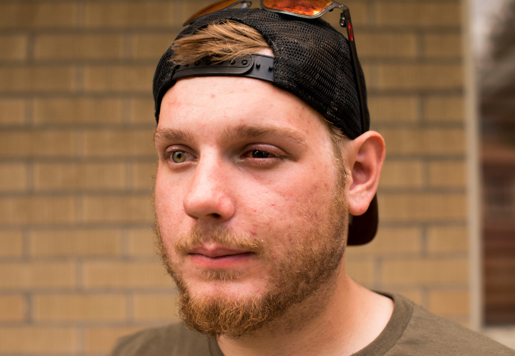 Denver protest bystander blind in one eye after being hit by
police with “less lethal” projectile 1