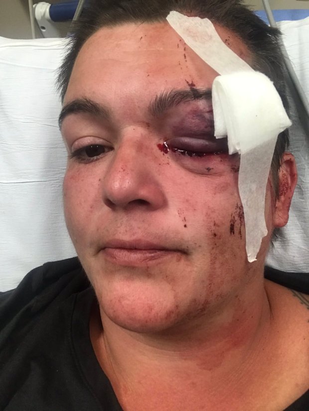 Journalist blinded by rubber bullet during protest sues
Minneapolis police, State Patrol 1