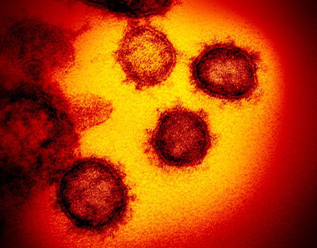 Los Gatos man charged with fraud for coronavirus testing
scheme 1