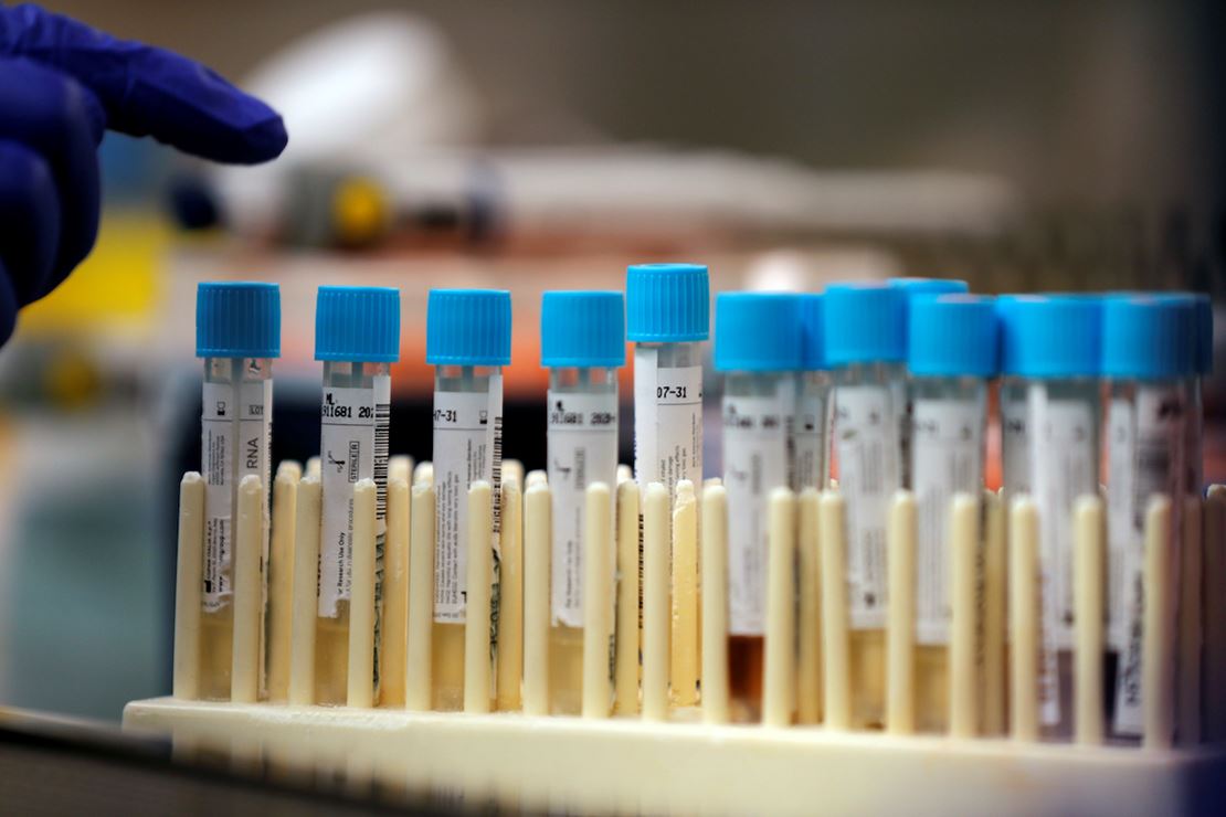 Study Finds Coronavirus Immunity May Be Fleeting 1