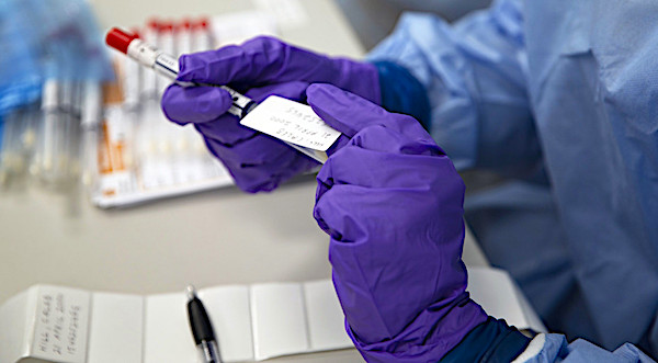 Super-potent antibodies show potential for vaccine-like
prevention of COVID-19 1