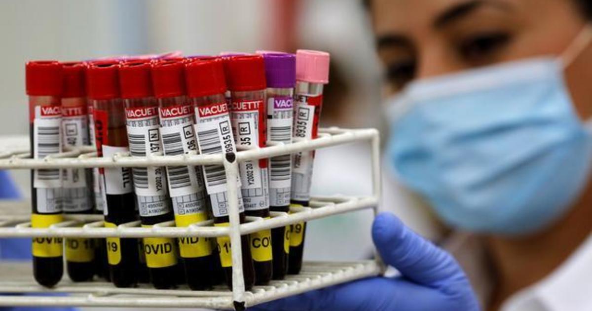 Rare "super" antibodies could be key in COVID-19 vaccine
race 1