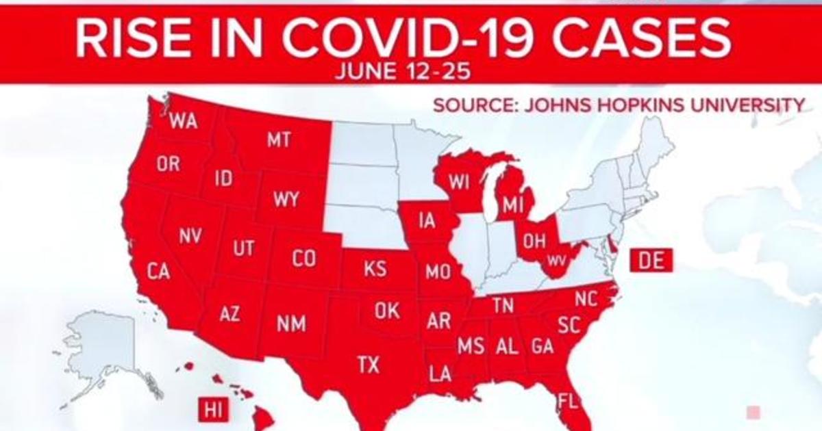 Coronavirus cases surge as pressure mounts on healthcare
workers 1
