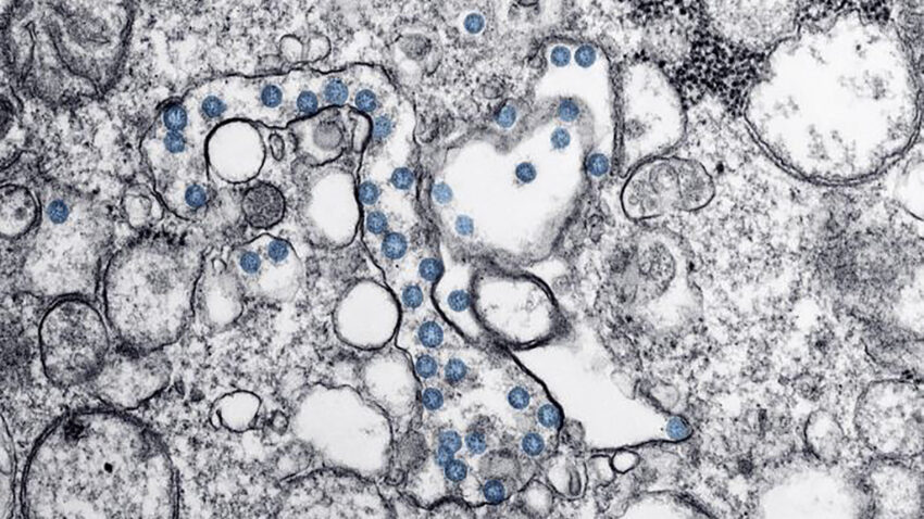 As case numbers drop, Mass. shows lowest coronavirus
transmission rate in the U.S. 1