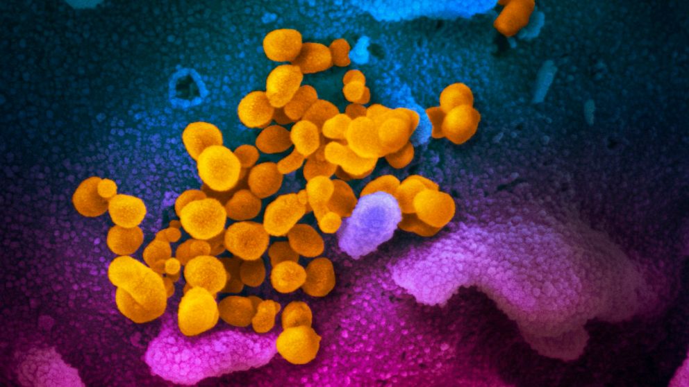 First drug proves able to improve survival from
COVID-19 1
