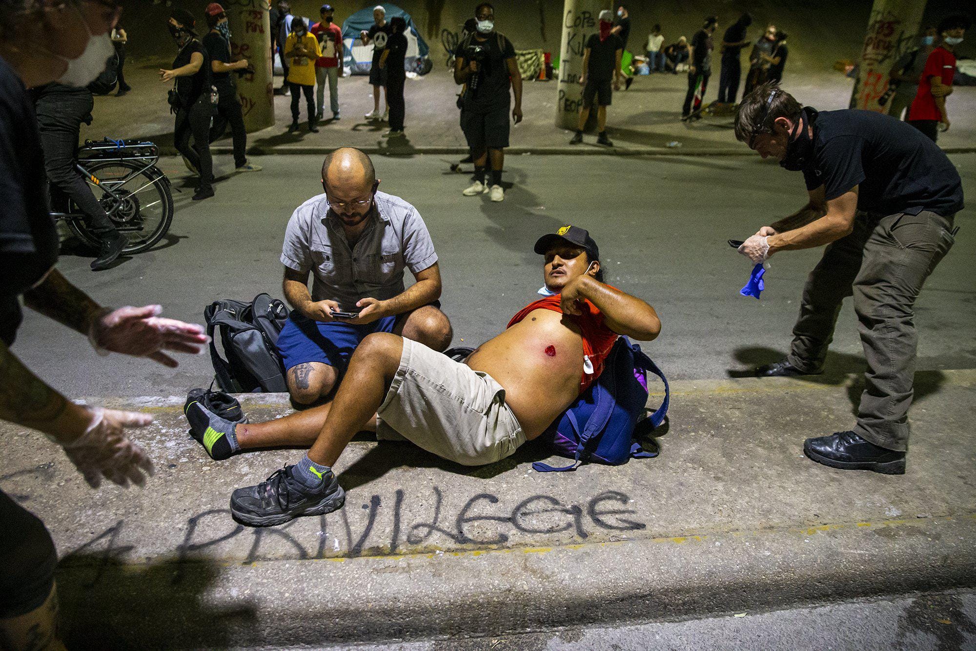 Fractured skulls, lost eyes: Police break their own rules
when shooting protesters with 'rubber bullets' 1