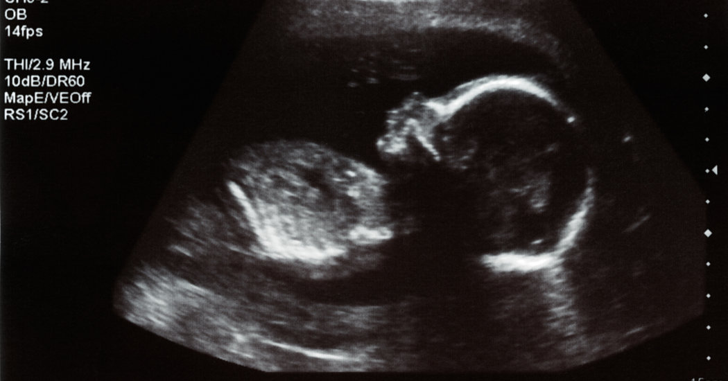 Baby Was Infected With Coronavirus in Womb, Study
Reports 1
