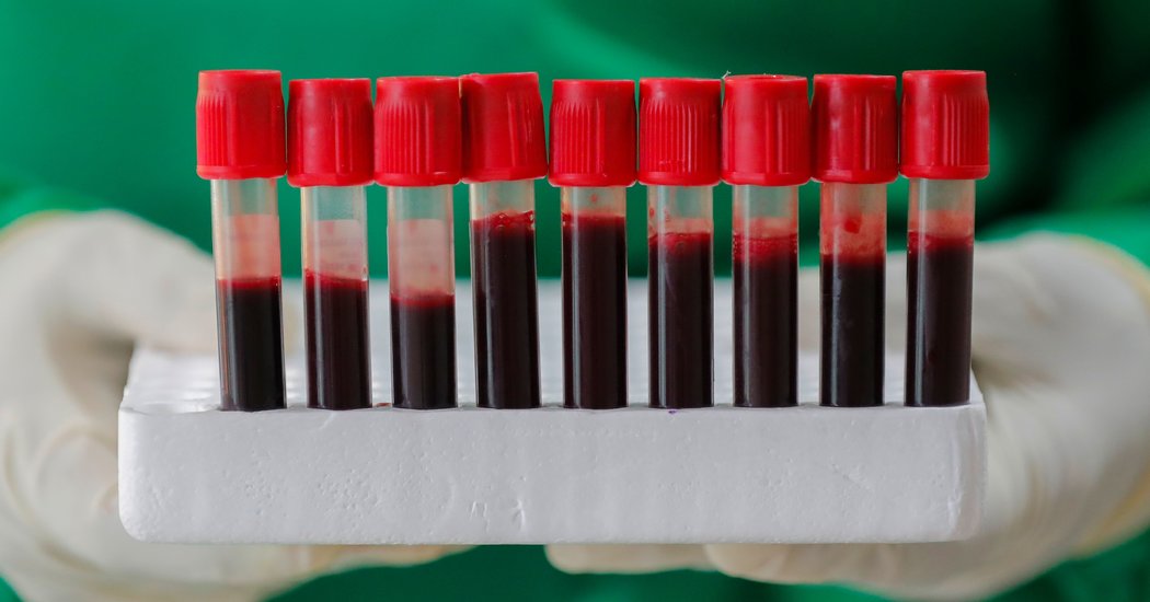 Does Blood Type Affect Your Risk Of Coronavirus? Probably
Not, New Studies Say 1