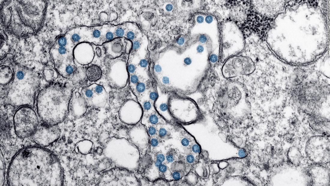 California: Factory ordered closed after over 300
coronavirus cases and 4 deaths 1