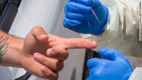 3 Arizona teachers caught coronavirus but only 2 survived.
This is what they want you to know 1
