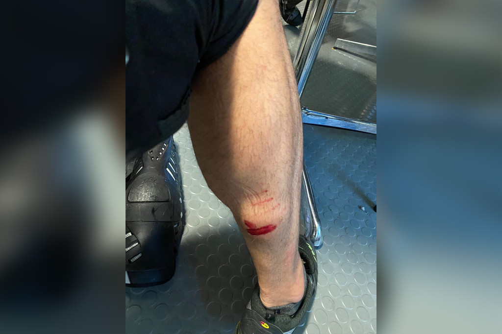 Seattle police show injuries, damage suffered from ongoing
riots 1