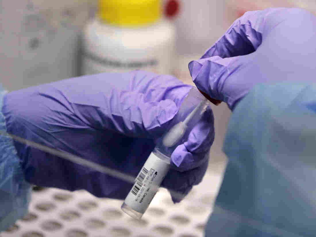 Federal Push For Faster, Cheaper Coronavirus Tests Focuses
On 7 New Technologies 1
