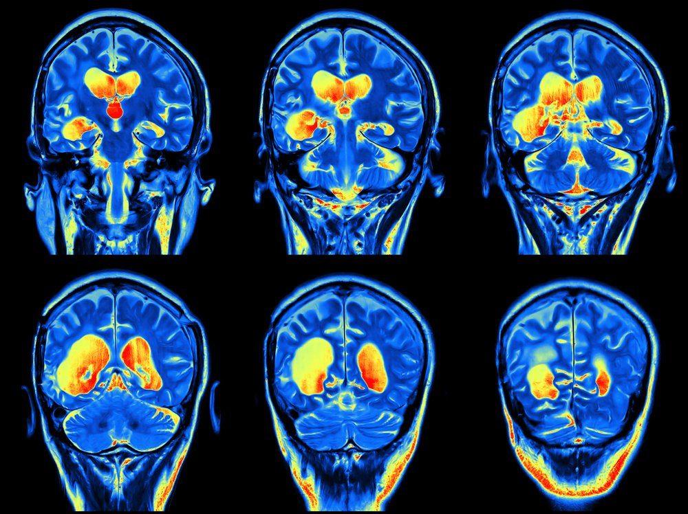 These Headlines Are Not Only Misleading but Instilling Fear
Without Facts: People With Mild COVID-19 May 1