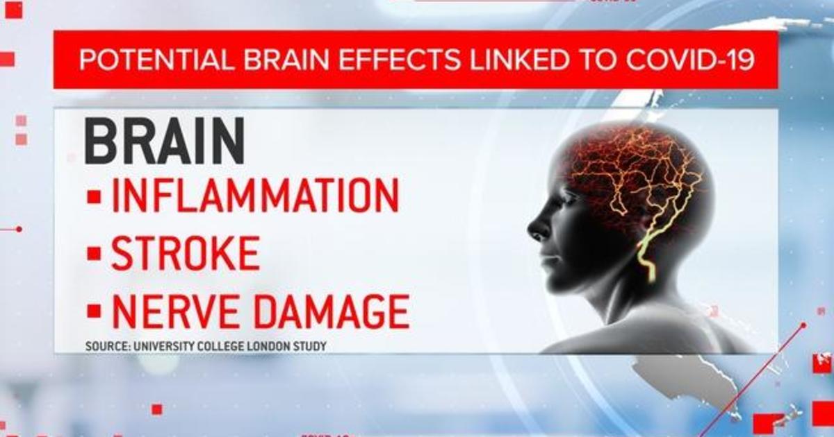 Scientists warn brain damage may be linked to
COVID-19 1