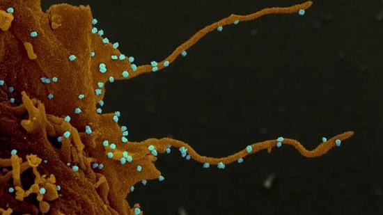 UK study shows COVID-19 antibodies fade quickly, rendering
vaccines pointless 1