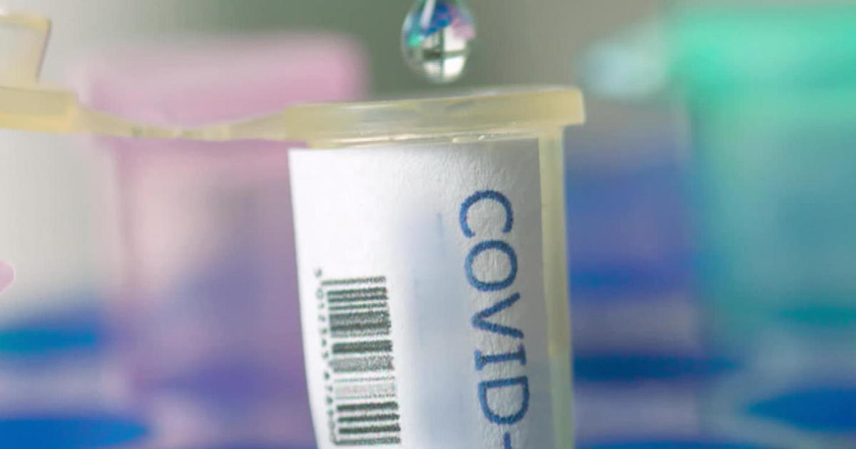 Non-government experts could pick who gets COVID-19 vaccine
first 1