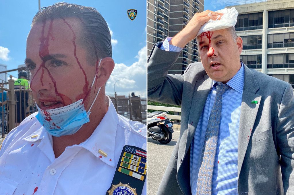 NYPD Chief of Department injured during protest on Brooklyn
Bridge 1