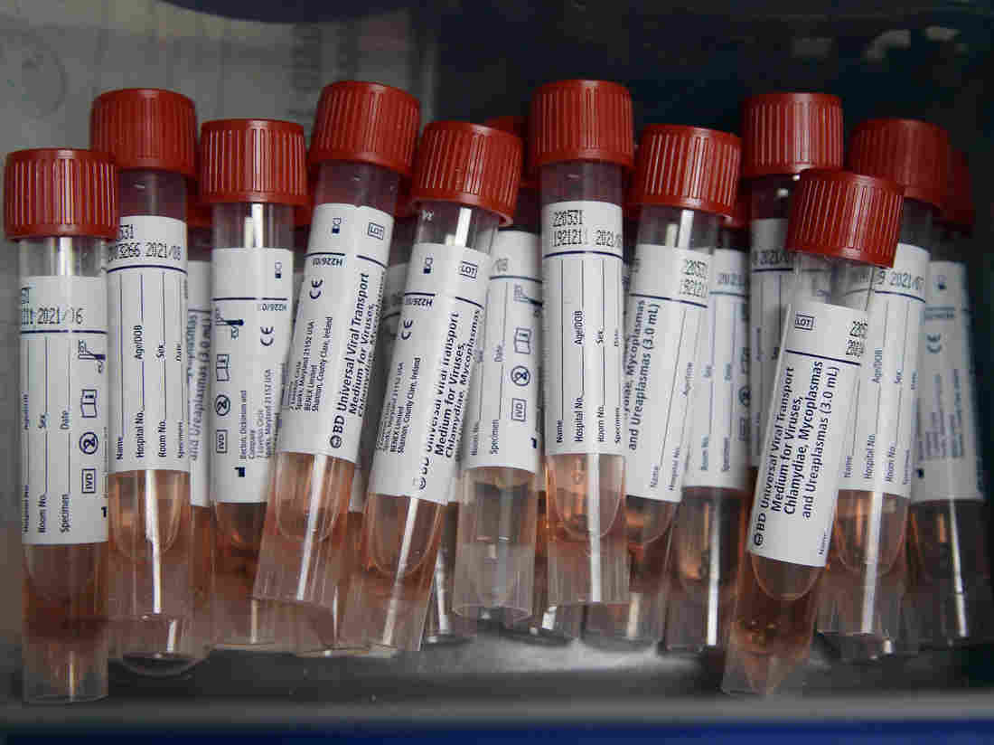 Pooling Coronavirus Tests Can Spare Scarce Supplies, But
There's A Catch 1