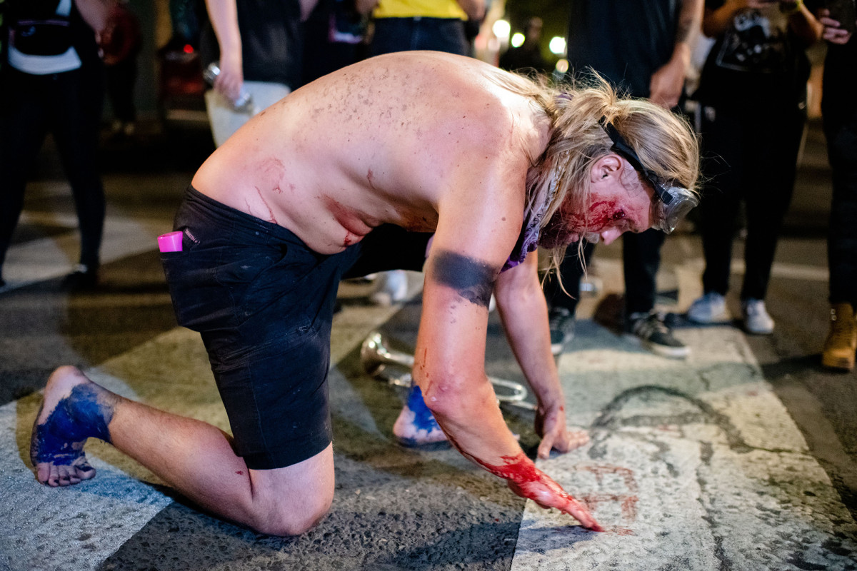 Portland protester writes ‘FEDS’ in own blood after being
shot in face 1