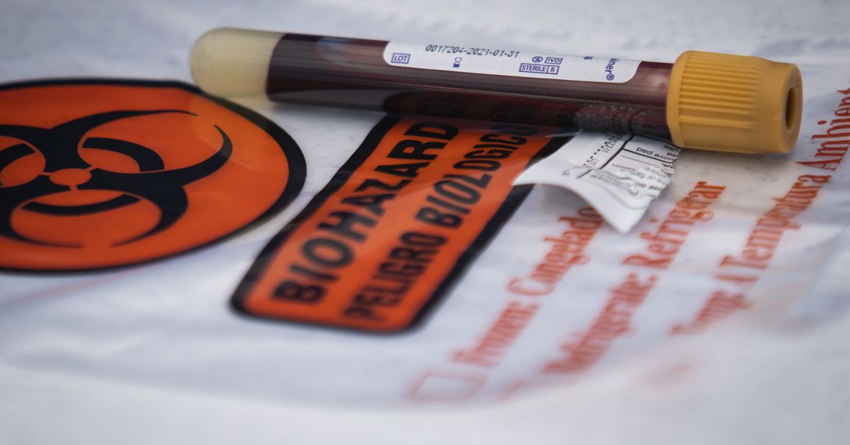 UIC to start COVID-19 vaccine trial Monday 1