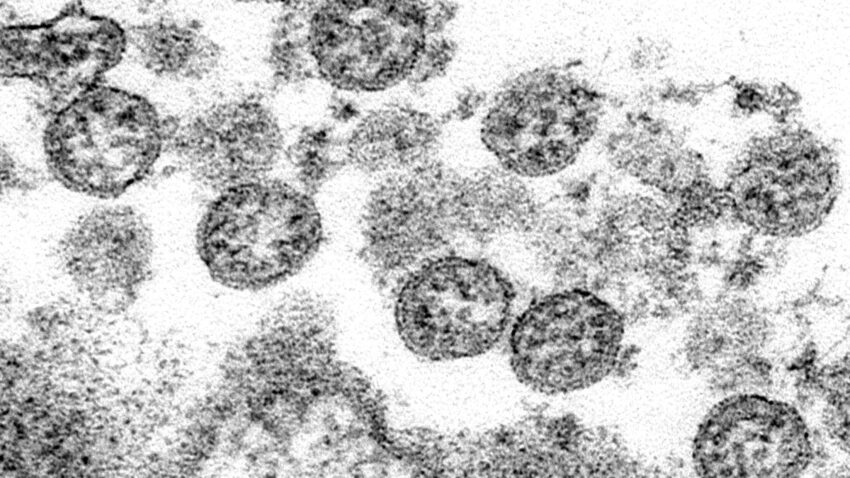 The coronavirus infected hundreds at a Georgia summer
camp 1