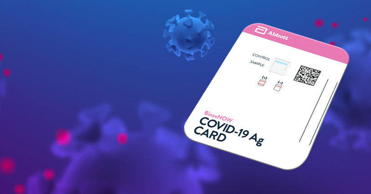 FDA greenlights $5 rapid coronavirus test by Abbott
Laboratories 1