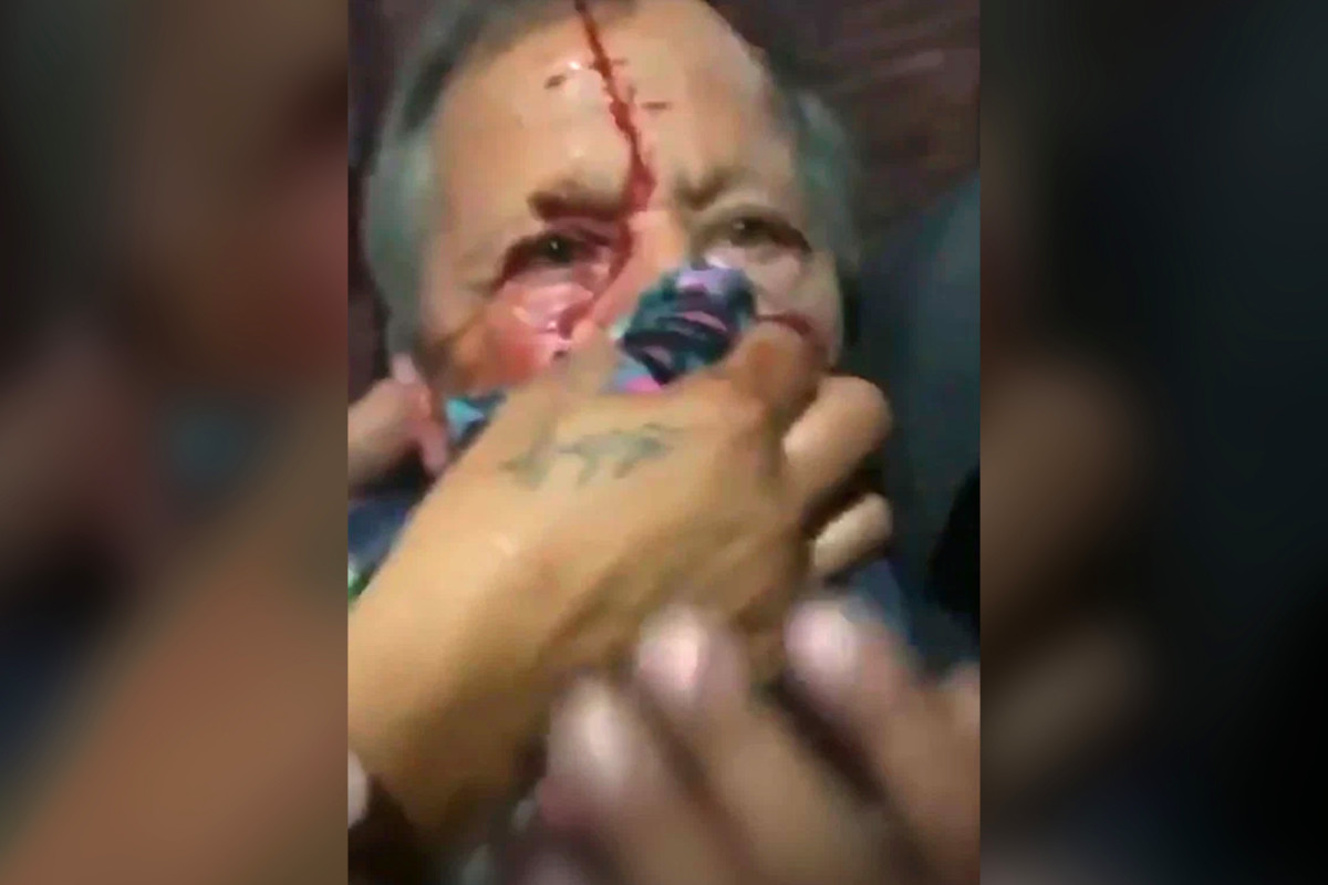 Elderly man defending store during Kenosha riots has jaw
broken 1