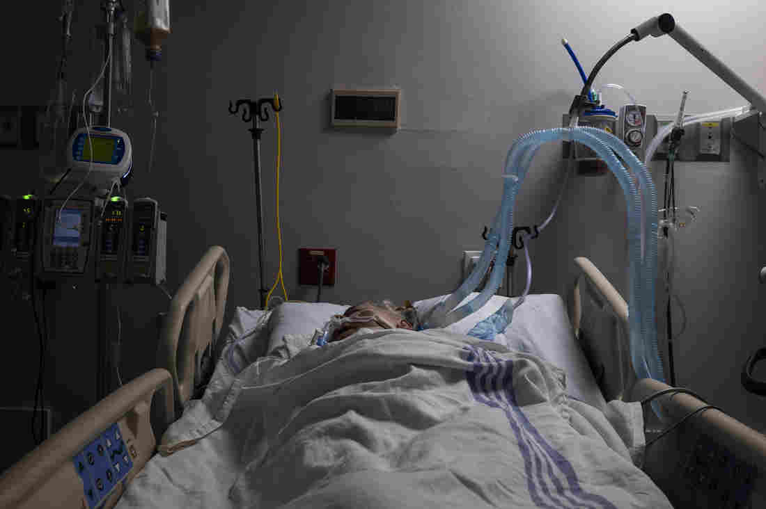 Another COVID-19 Medical Mystery: Patients Come Off
Ventilator, But Linger In A Coma 1