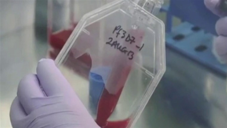 Fauci 'has some concern' about change in COVID-19 testing
guidelines 1