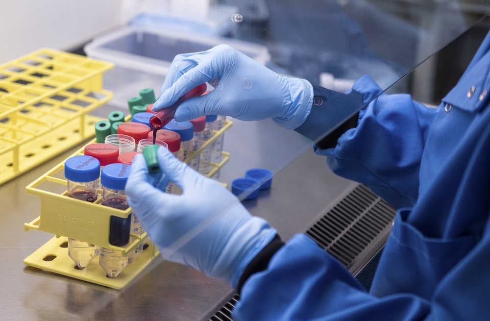 Those coronavirus vaccines leading the race? Don’t ditch the
masks quite yet 1