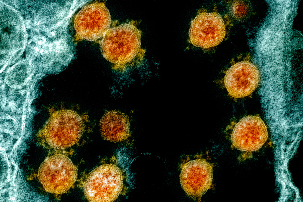 Coronavirus: Drugmaker touts potential treatment for less
severe cases of COVID-19 1
