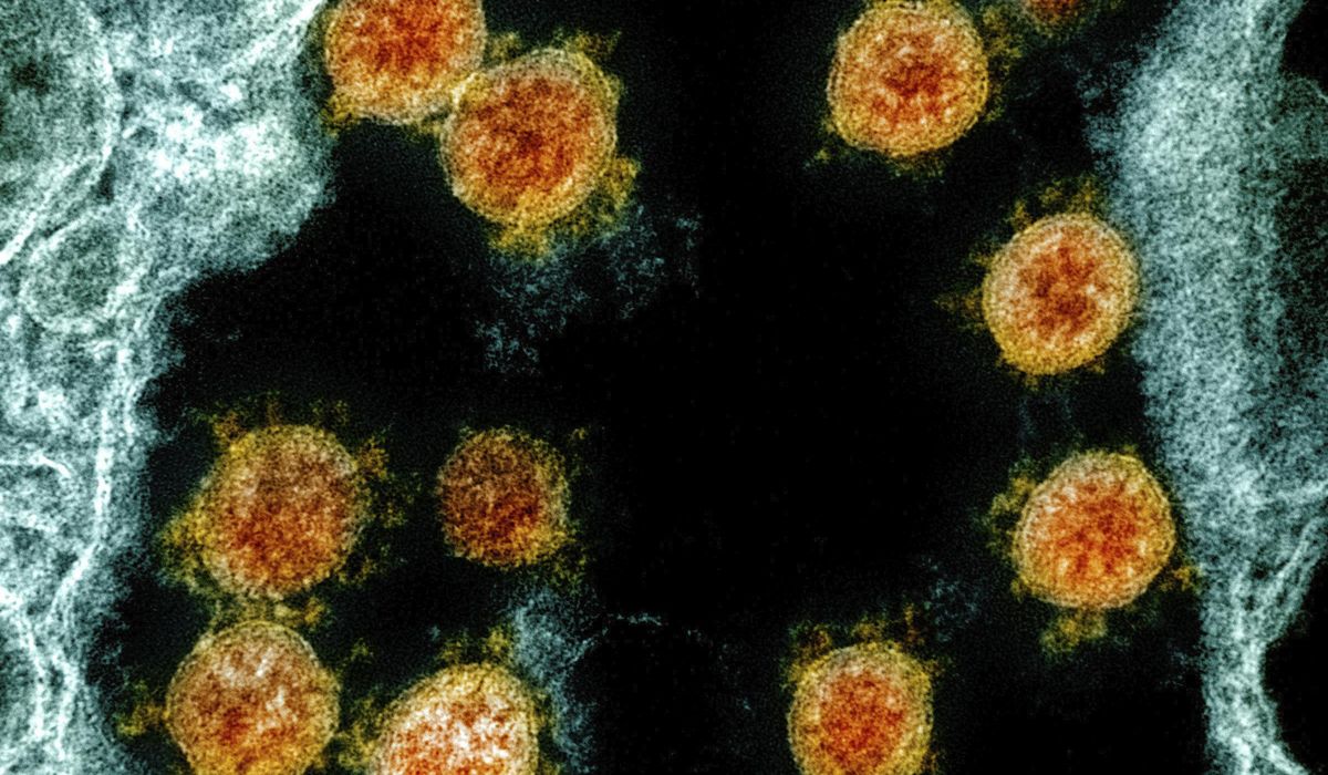 Scientists say Hong Kong man got coronavirus a second
time 1