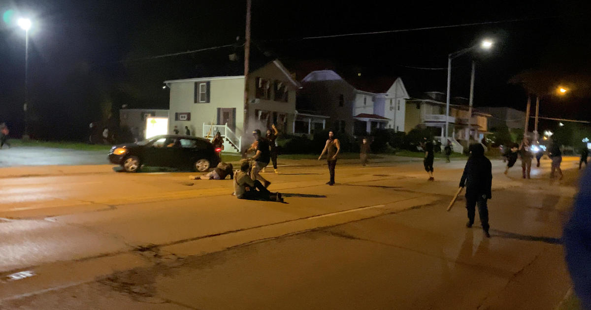 Lone survivor of Kenosha protest shooting "in constant
pain" 1