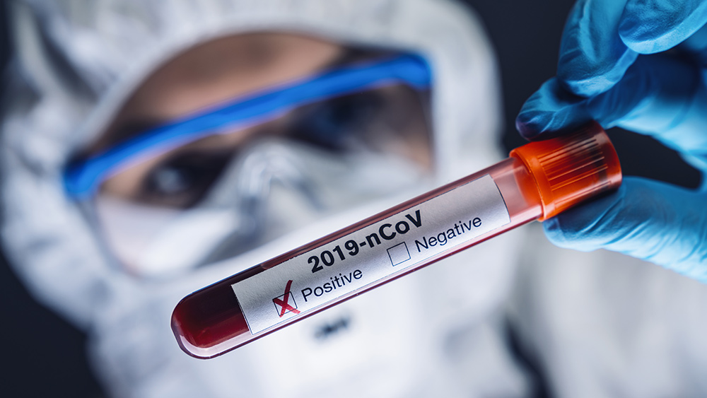 BOMBSHELL: Up to 90% of COVID-19 “positive” test results are
false, test kits matching dead viral fragments that pose no
infection risk 1 BOMBSHELL: Up to 90% of COVID-19 “positive” test results are
false, test kits matching dead viral fragments that pose no
infection risk 1