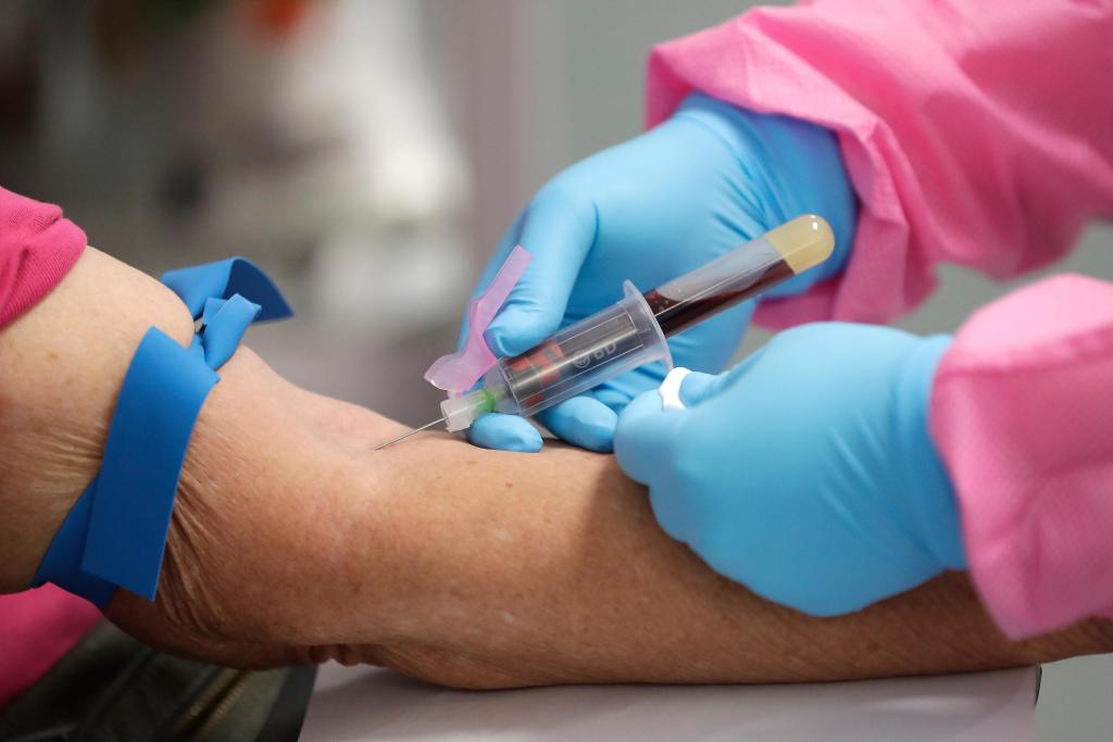 Bold hopes for coronavirus antibody tests still
unfulfilled 1