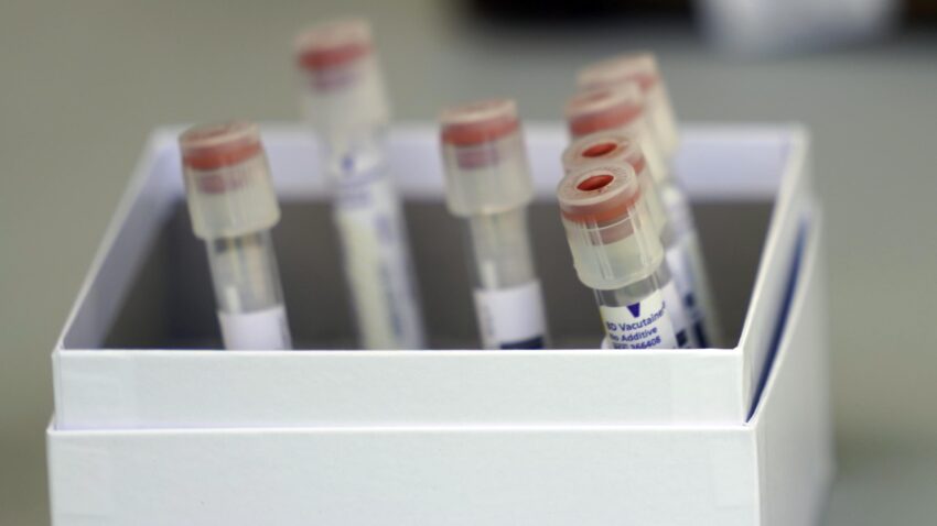Mass. reports 10 new COVID-19 deaths, 370 new cases 1