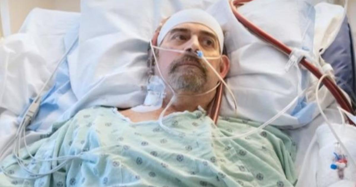 COVID-19 patient saved by rare double lung
transplant 1