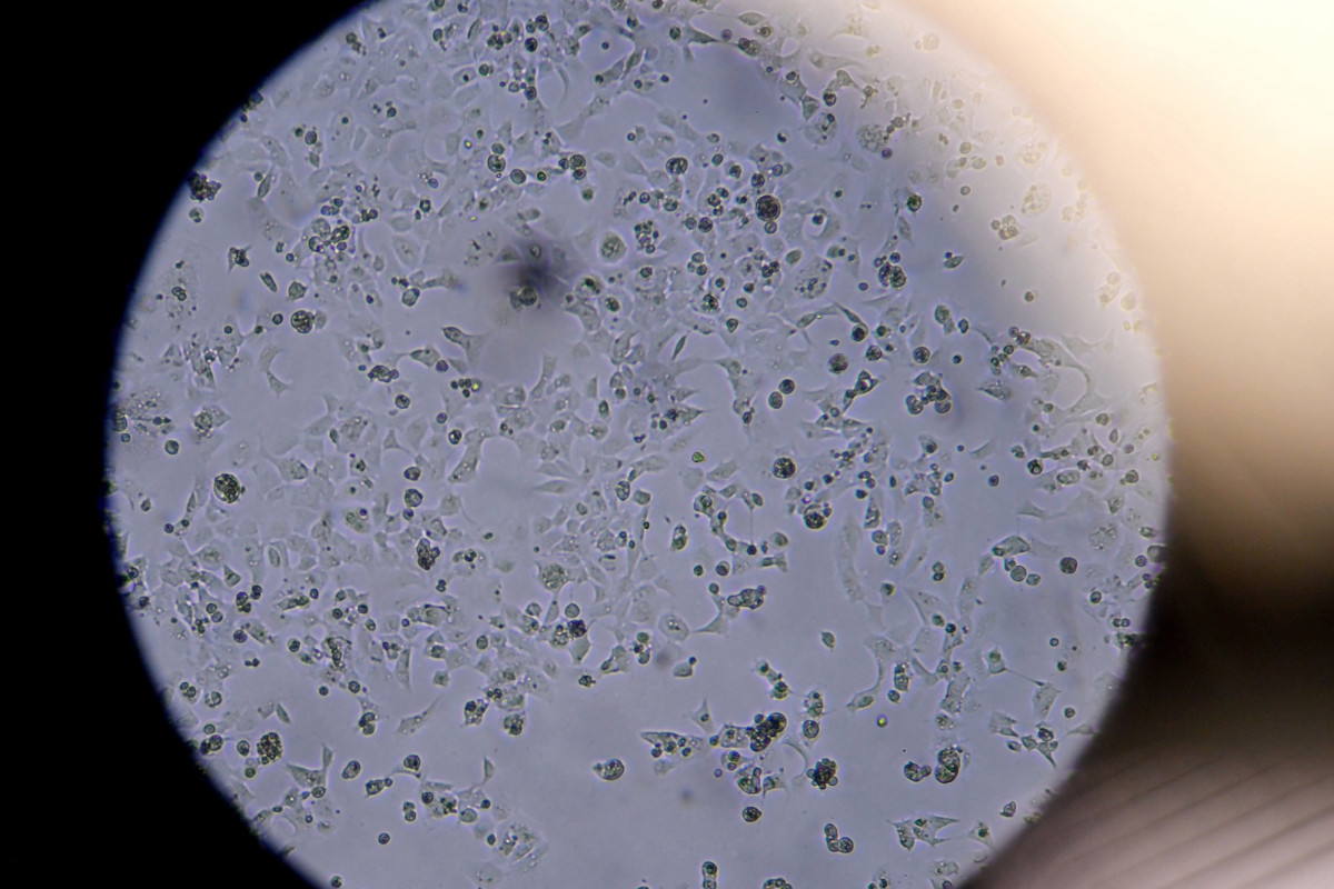 Why poop tests may be a better way to detect
COVID-19 1