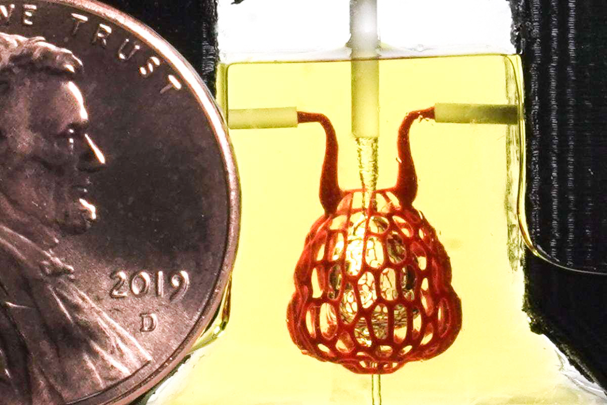 A DARPA-Funded Implantable Biochip to Detect COVID-19 Could
Hit Markets by 2021 1